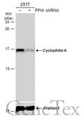 Anti-Cyclophilin A antibody [N1C3] used in Western Blot (WB). GTX113520