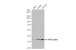 Anti-PP2A alpha antibody used in Western Blot (WB). GTX113523