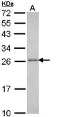 Anti-PSMA3 antibody used in Western Blot (WB). GTX113529