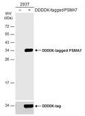 Anti-PSMA7 antibody [N1C2] used in Western Blot (WB). GTX113531