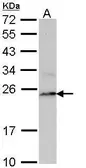 Anti-PSMB8 antibody [N2C3] used in Western Blot (WB). GTX113533