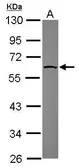 Anti-Nectin 2 antibody [N1N3] used in Western Blot (WB). GTX113535