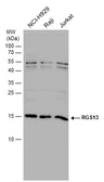 Anti-RGS13 antibody [N1C3] used in Western Blot (WB). GTX113540