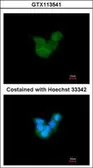 Anti-CRALBP antibody [N2C3] used in Immunocytochemistry/ Immunofluorescence (ICC/IF). GTX113541