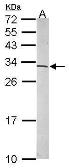 Anti-RPS6 antibody used in Western Blot (WB). GTX113542