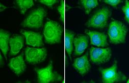 Anti-RPS6 antibody used in Immunocytochemistry/ Immunofluorescence (ICC/IF). GTX113542