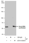 Anti-Seryl-tRNA synthetase antibody [N1C2] used in Immunoprecipitation (IP). GTX113546