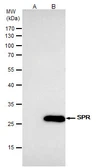 Anti-SPR antibody [N2C3] used in Immunoprecipitation (IP). GTX113552