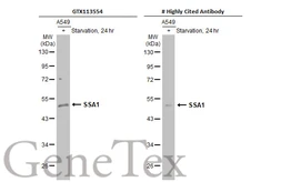 Anti-SSA1 antibody [C1C3] used in Western Blot (WB). GTX113554
