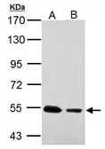 Anti-SSB antibody used in Western Blot (WB). GTX113555