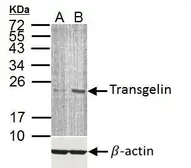 Anti-Transgelin antibody used in Western Blot (WB). GTX113561