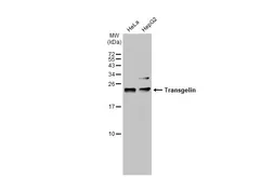 Anti-Transgelin antibody used in Western Blot (WB). GTX113561