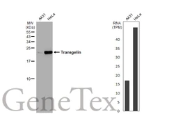 Anti-Transgelin antibody used in Western Blot (WB). GTX113561