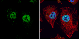 Anti-LXR beta antibody [N2C2], Internal used in Immunocytochemistry/ Immunofluorescence (ICC/IF). GTX113571