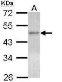 Anti-LXR beta antibody [N2C2], Internal used in Western Blot (WB). GTX113571