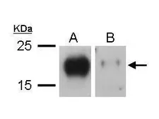 Anti-VEGFC antibody used in Western Blot (WB). GTX113574