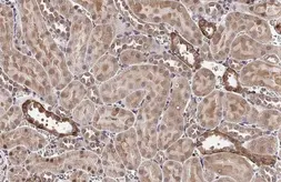 Anti-VEGFC antibody used in IHC (Paraffin sections) (IHC-P). GTX113574