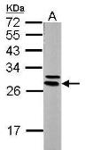 Anti-14-3-3 epsilon antibody [N2C3] used in Western Blot (WB). GTX113576