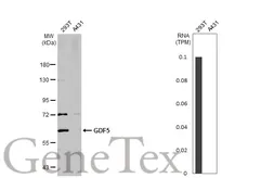 Anti-GDF5 antibody used in Western Blot (WB). GTX113580