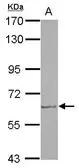 Anti-GDF5 antibody used in Western Blot (WB). GTX113580