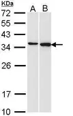 Anti-Pirin antibody [N2C3] used in Western Blot (WB). GTX113585