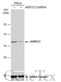Anti-AKR1C3 antibody [N1C1] used in Western Blot (WB). GTX113586