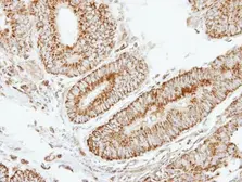 Anti-EIF2B beta antibody [N2C3] used in IHC (Paraffin sections) (IHC-P). GTX113590