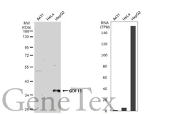 Anti-GDF15 antibody [N1C3] used in Western Blot (WB). GTX113598