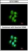 Anti-MVP/LRP antibody used in Immunocytochemistry/ Immunofluorescence (ICC/IF). GTX113601