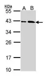 Anti-SAE1 antibody used in Western Blot (WB). GTX113602