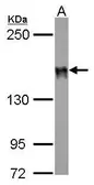 Anti-DLC1 antibody [C2C3], C-term used in Western Blot (WB). GTX113607