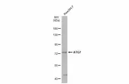 Anti-ATG7 antibody [N3C2], Internal used in Western Blot (WB). GTX113613