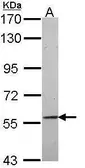 Anti-CIKS antibody [C1C3] used in Western Blot (WB). GTX113615