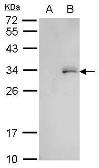 Anti-GFP antibody (HRP) used in Western Blot (WB). GTX113618-01