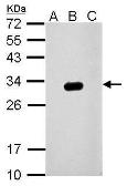 Anti-GFP antibody used in Western Blot (WB). GTX113618