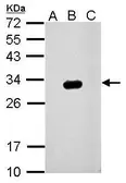 Anti-GFP antibody used in Western Blot (WB). GTX113618