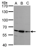 Anti-Steroid sulfatase antibody used in Western Blot (WB). GTX113628