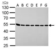 Anti-ASL antibody used in Western Blot (WB). GTX113629