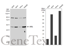 Anti-ASL antibody used in Western Blot (WB). GTX113629