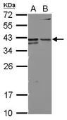 Anti-CD147 antibody [N2C3-2] used in Western Blot (WB). GTX113636