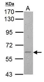 Anti-Cav beta 4 antibody used in Western Blot (WB). GTX113638