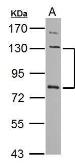 Anti-P-Cadherin antibody used in Western Blot (WB). GTX113648