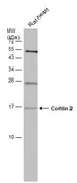 Anti-Cofilin 2 antibody used in Western Blot (WB). GTX113650