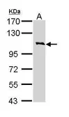 Anti-IL3 Receptor beta antibody [N1N2], N-term used in Western Blot (WB). GTX113659