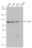 Anti-CYLD antibody [N1N2], N-term used in Western Blot (WB). GTX113662