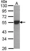 Anti-Cytochrome P450 2D6 antibody used in Western Blot (WB). GTX113667