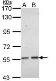 Anti-CYP17A1 antibody [N3C2], Internal used in Western Blot (WB). GTX113670