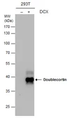 Anti-Doublecortin antibody [N1C2] used in Western Blot (WB). GTX113671