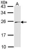 Anti-Endothelin 3 antibody [N1C3] used in Western Blot (WB). GTX113678