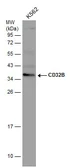 Anti-CD32B antibody [N2C3] used in Western Blot (WB). GTX113693